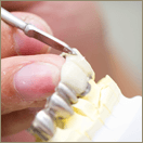 「歯の職人」歯科技工士常駐